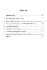 Pleomorphic Adenoma - Retail Maharaj