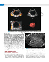 DECISION MAKING IN TRANSVAGINAL SONOGRAPHY - Retail Maharaj