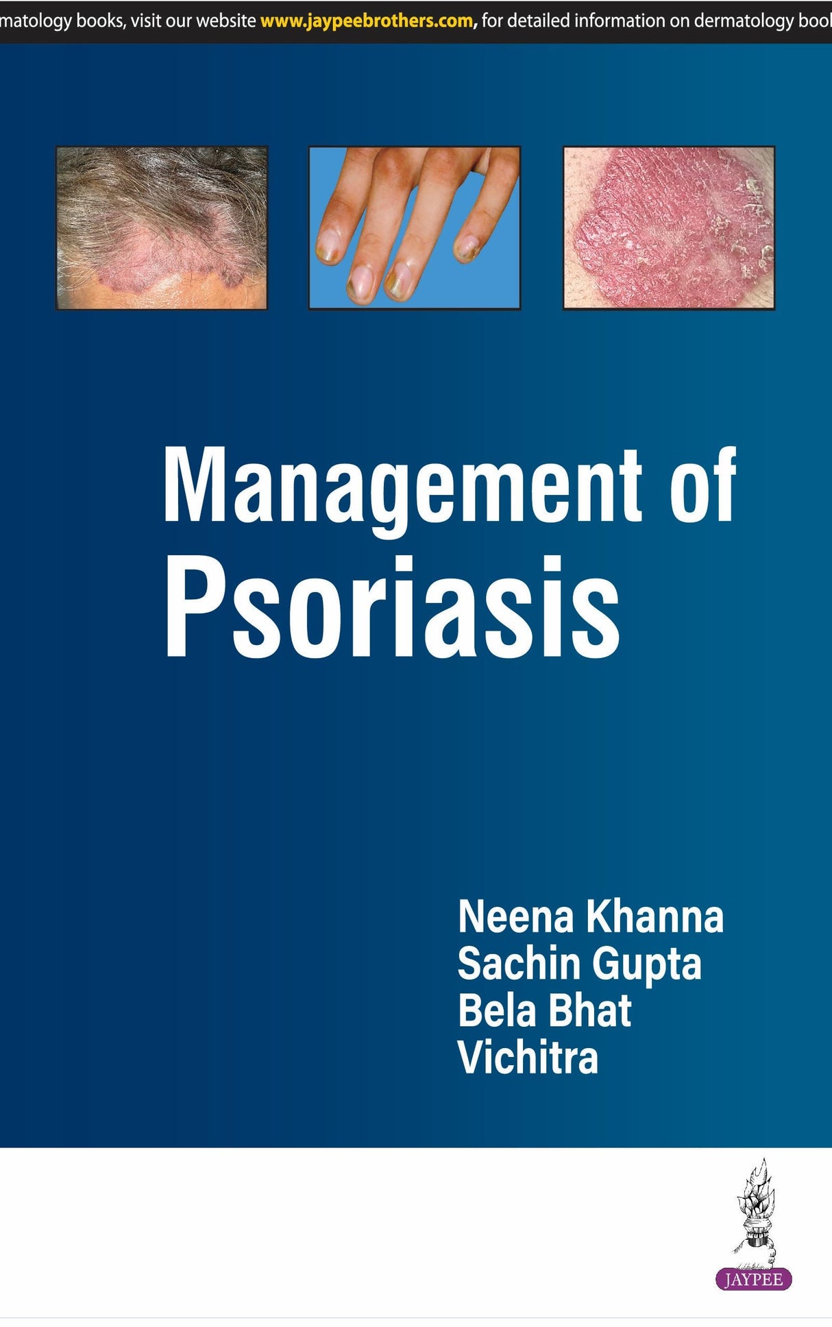 MANAGEMENT OF PSORIASIS - Retail Maharaj