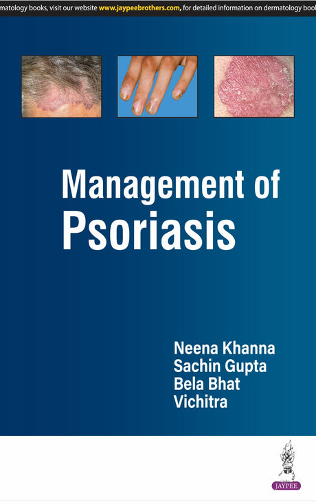 MANAGEMENT OF PSORIASIS - Retail Maharaj