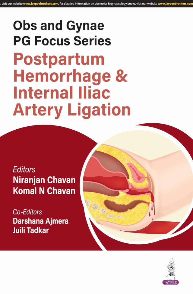 OBS AND GYNAE PG FOCUS SERIES POSTPARTUM HEMORRHAGE & INTERNAL ILIAC ARTERY LIGATION - Retail Maharaj