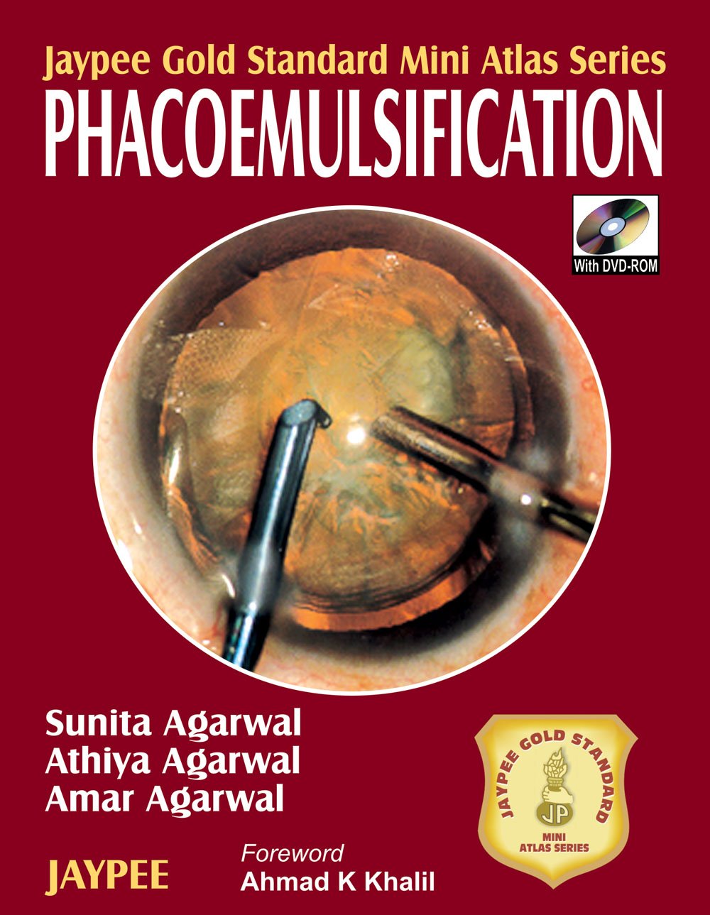 Jaypee Gold Standard Mini Atlas Series Phacoemulsification with DVD-ROM - Retail Maharaj