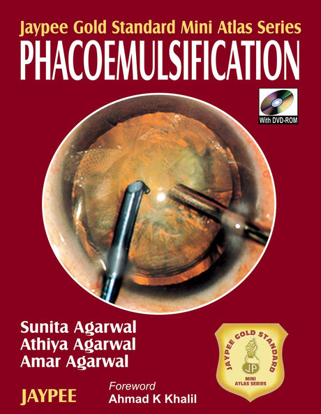 Jaypee Gold Standard Mini Atlas Series Phacoemulsification with DVD-ROM - Retail Maharaj