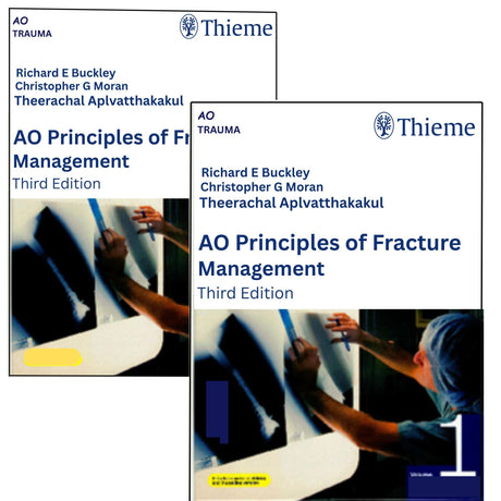 AO Principles of Fracture Management 2 Vol. Set, Vol. 1: Principles, Vol. 2: Specific fractures - Retail Maharaj