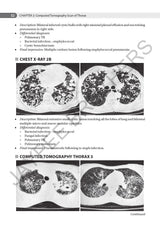AN AID TO RESPIRATORY MEDICINE FOR POSTGRADUATE EXIT EXAM (MD, DNB AND DIPLOMA) - Retail Maharaj