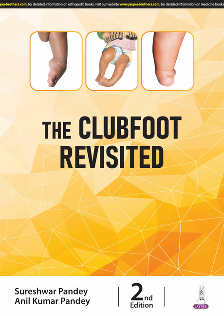 THE CLUBFOOT REVISITED - Retail Maharaj