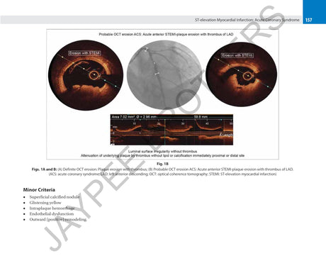 CORONARY OCT A CASE-BASED APPROACH - Retail Maharaj