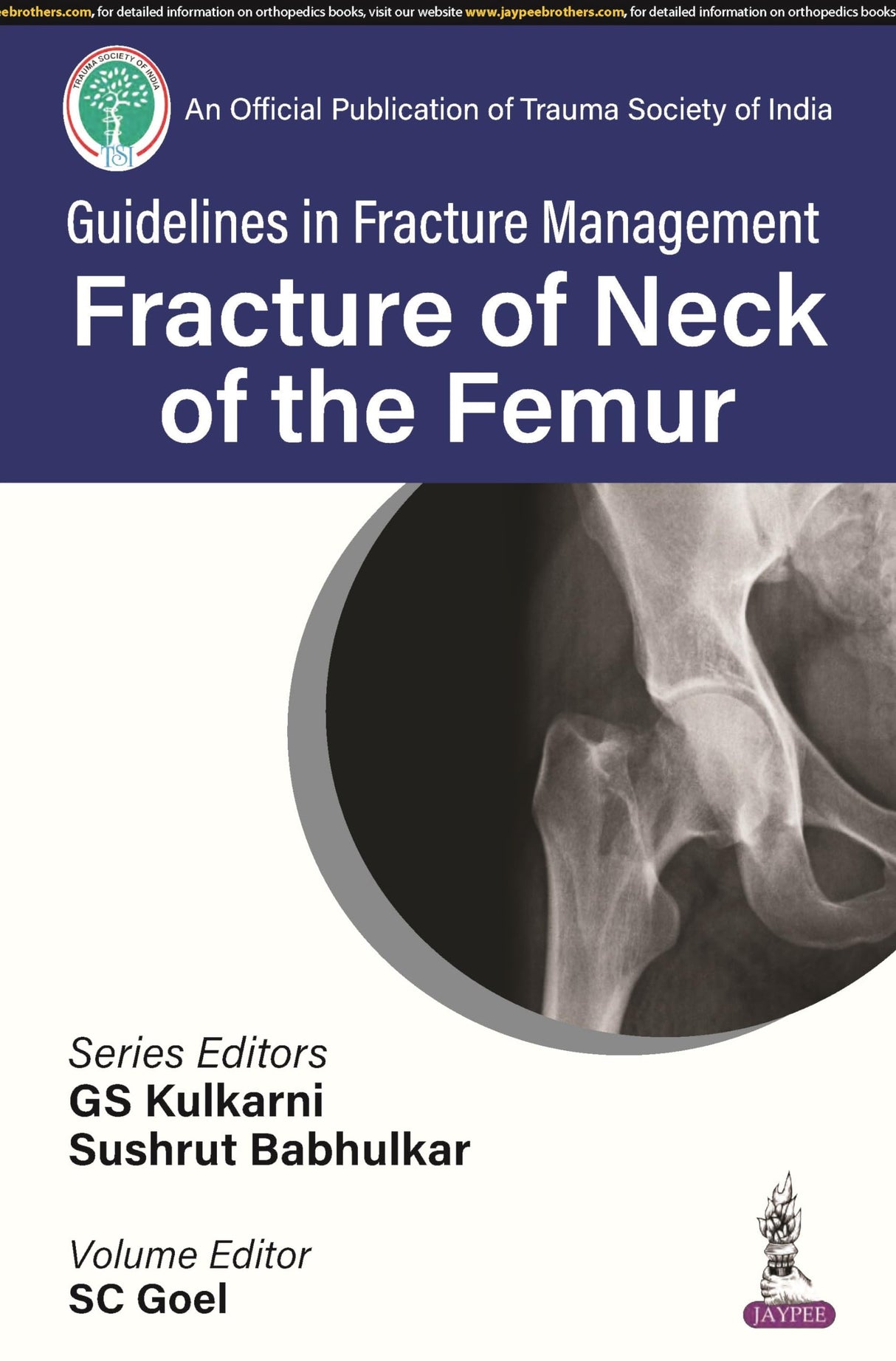 GUIDELINES IN FRACTURE MANAGEMENT FRACTURE OF NECK OF THE FEMUR - Retail Maharaj