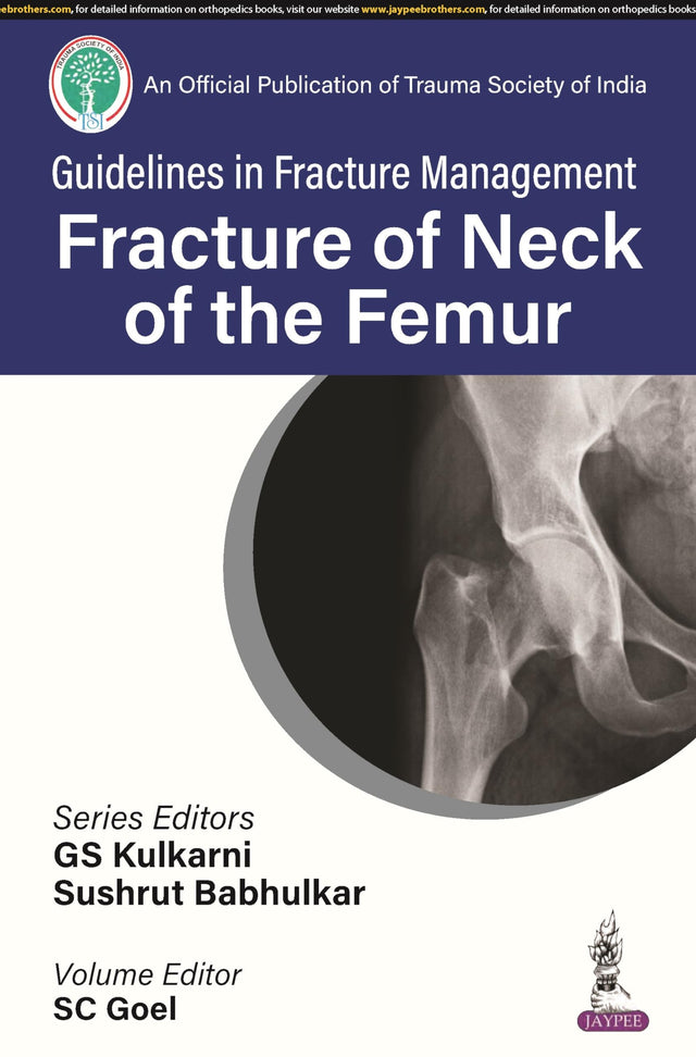 GUIDELINES IN FRACTURE MANAGEMENT FRACTURE OF NECK OF THE FEMUR - Retail Maharaj