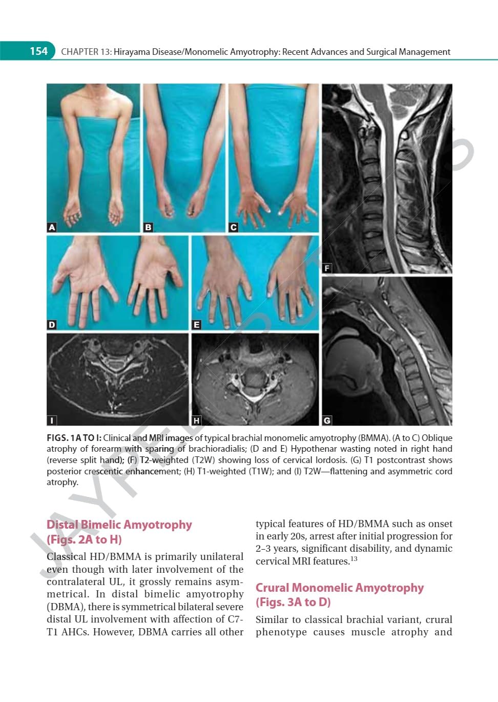IAN ADVANCES IN NEUROMUSCULAR DISORDERS - Retail Maharaj