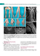 IAN ADVANCES IN NEUROMUSCULAR DISORDERS - Retail Maharaj