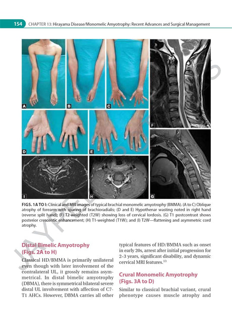 IAN ADVANCES IN NEUROMUSCULAR DISORDERS - Retail Maharaj