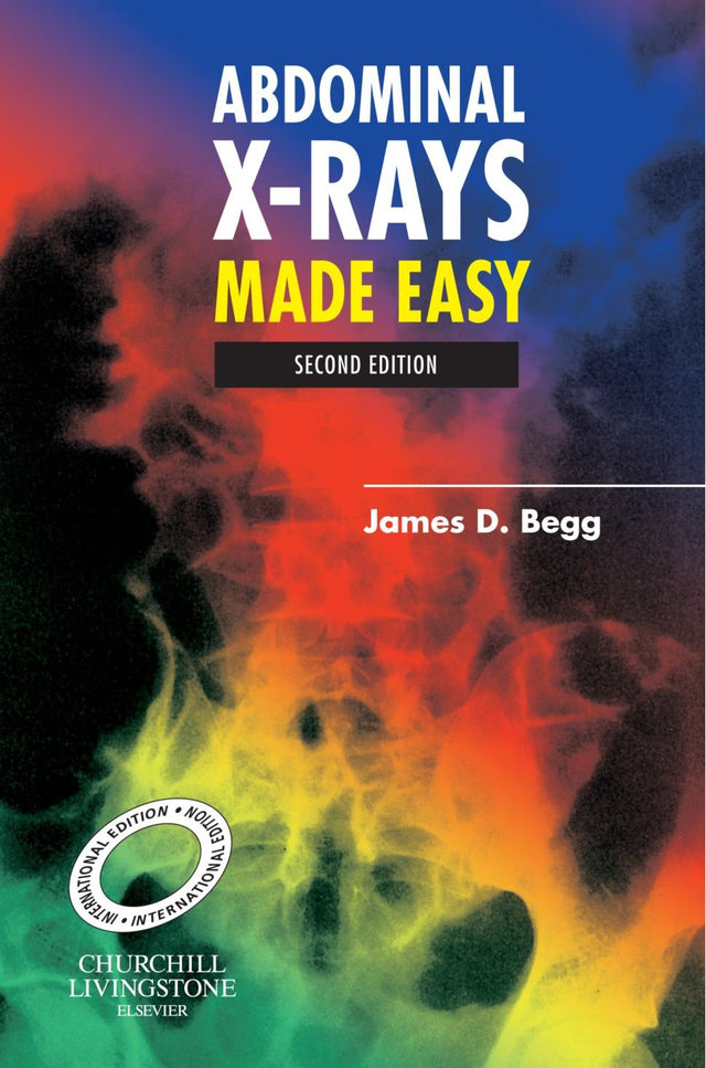ABDOMINAL X-RAY MADE EASY(INT.ED) - Retail Maharaj