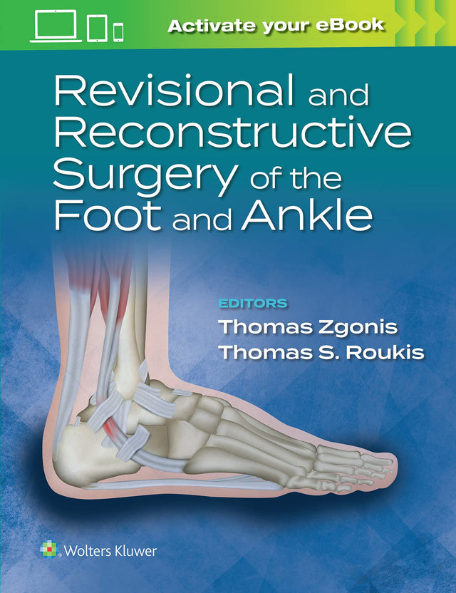 REVISIONAL AND RECONSTRUCTIVE SURGERY OF THE FOOT AND ANKLE HB 2023) - Retail Maharaj