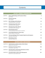 PRINCIPLES AND PRACTICE OF BURN CARE - Retail Maharaj