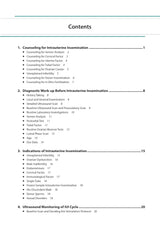 PRACTICAL GUIDE TO INTRAUTERINE INSEMINATION (IUI) - Retail Maharaj
