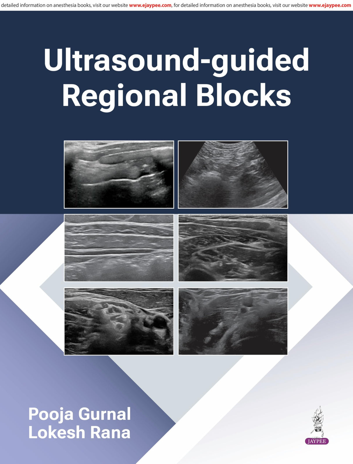 Ultrasound-Guided Regional Blocks - Retail Maharaj