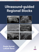 Ultrasound-Guided Regional Blocks - Retail Maharaj