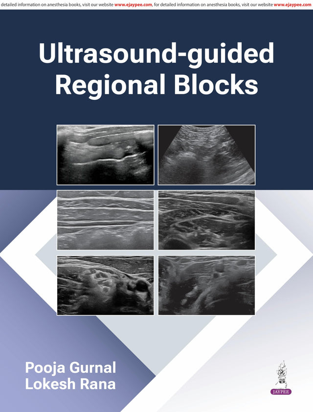 Ultrasound-Guided Regional Blocks - Retail Maharaj