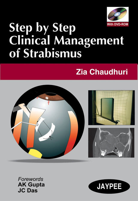 STEP BY STEP CLINICAL MANAGEMENT OF STRABISMUS WITH DVD-ROM - Retail Maharaj