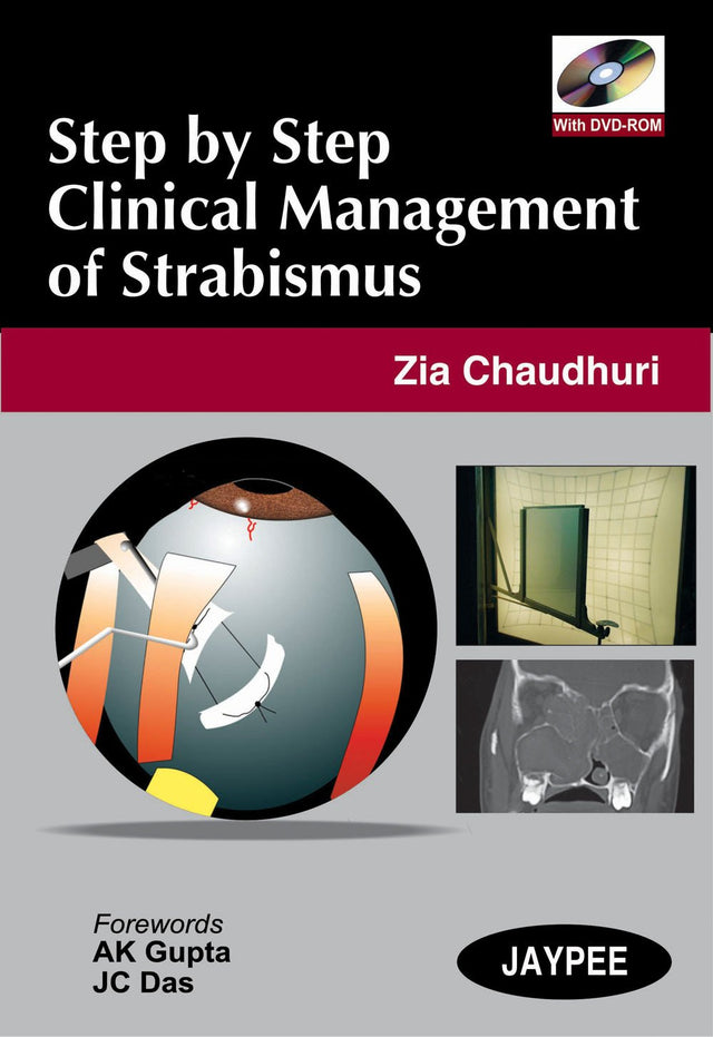 STEP BY STEP CLINICAL MANAGEMENT OF STRABISMUS WITH DVD-ROM - Retail Maharaj