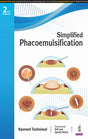 SIMPLIFIED PHACOEMULSIFICATION - Retail Maharaj