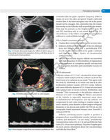DECISION MAKING IN TRANSVAGINAL SONOGRAPHY - Retail Maharaj