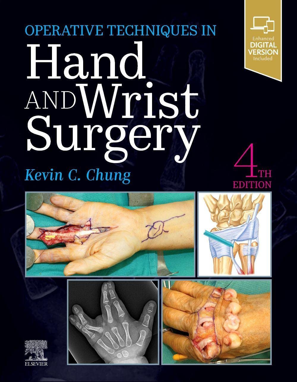 Operative Techniques Hand And Wrist Surgery With Access Code 4Ed (Hb 2023) - Retail Maharaj