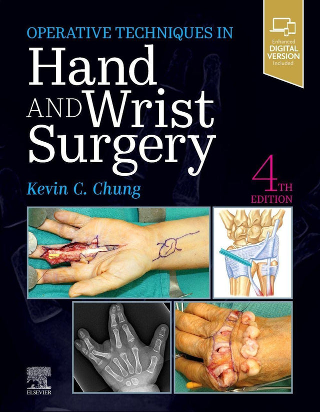 Operative Techniques Hand And Wrist Surgery With Access Code 4Ed (Hb 2023) - Retail Maharaj