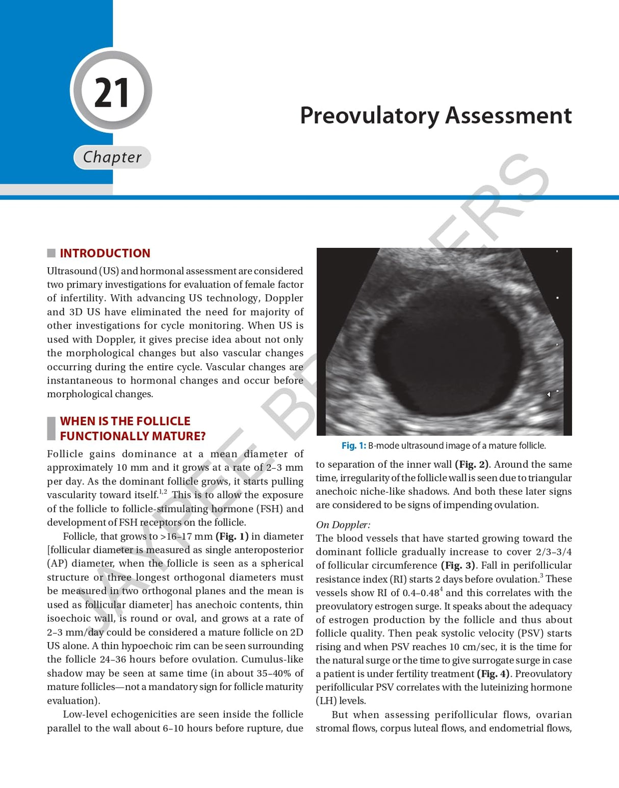 DECISION MAKING IN TRANSVAGINAL SONOGRAPHY - Retail Maharaj