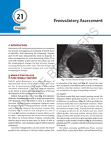 DECISION MAKING IN TRANSVAGINAL SONOGRAPHY - Retail Maharaj