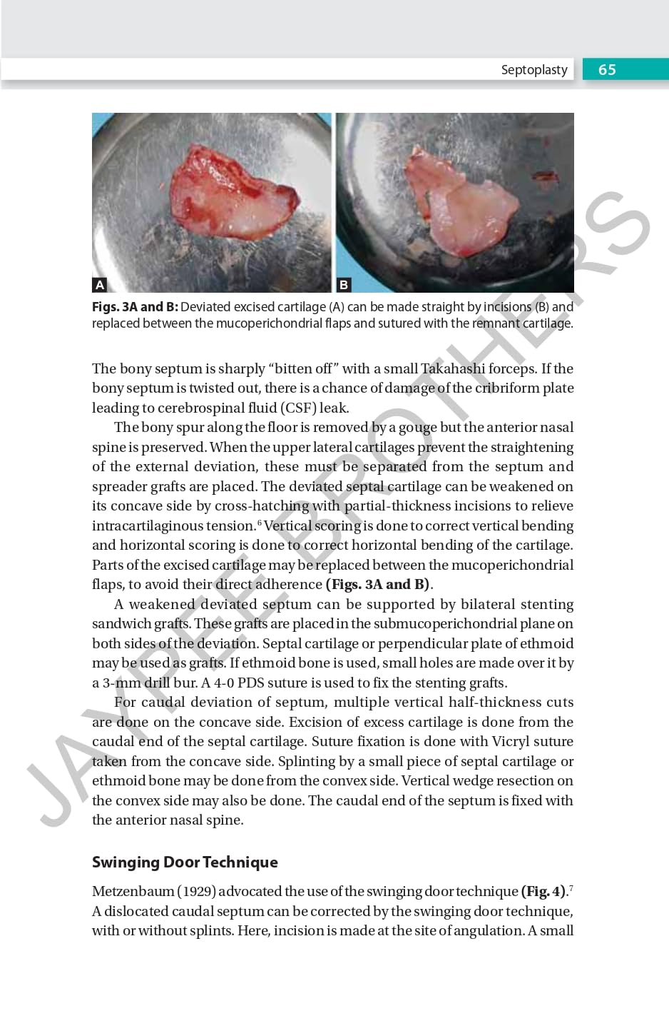 RHINOPLASTY AN EXPERT MANUAL - Retail Maharaj