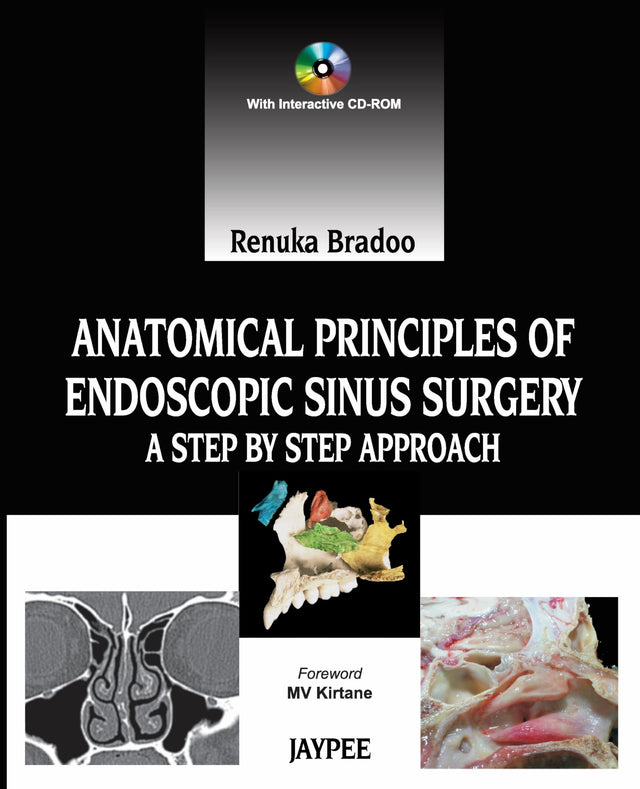 ANATOMICAL PRINCIPLES OF ENDOSCOPIC SINUS SURGERY: A STEP BY STEP APPROACH WITH INTERACTIVE CD-ROM - Retail Maharaj