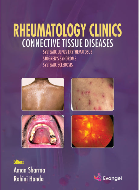 Rheumatology clinics Connective Tissue Diseases - Retail Maharaj