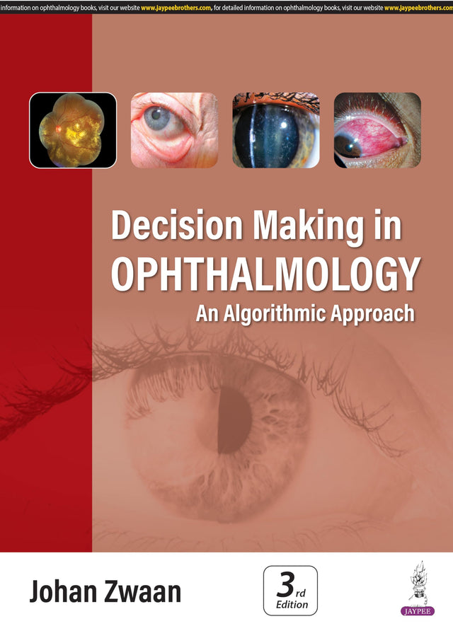 Decision Making in Ophthalmology: An Algorithmic Approach - Retail Maharaj
