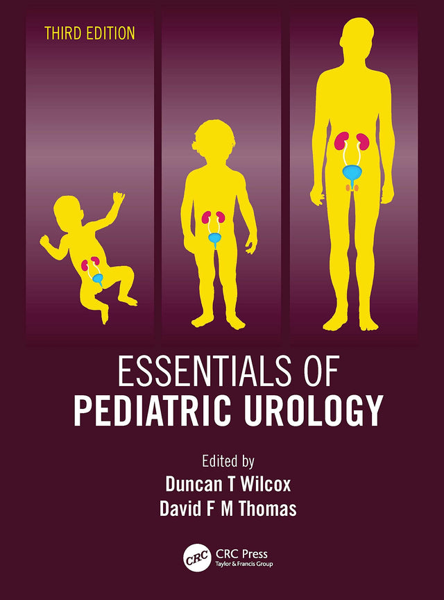 Essentials of Pediatric Urology - Retail Maharaj