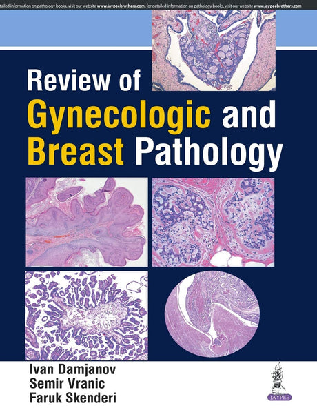 REVIEW OF GYNECOLOGIC AND BREAST PATHOLOGY - Retail Maharaj