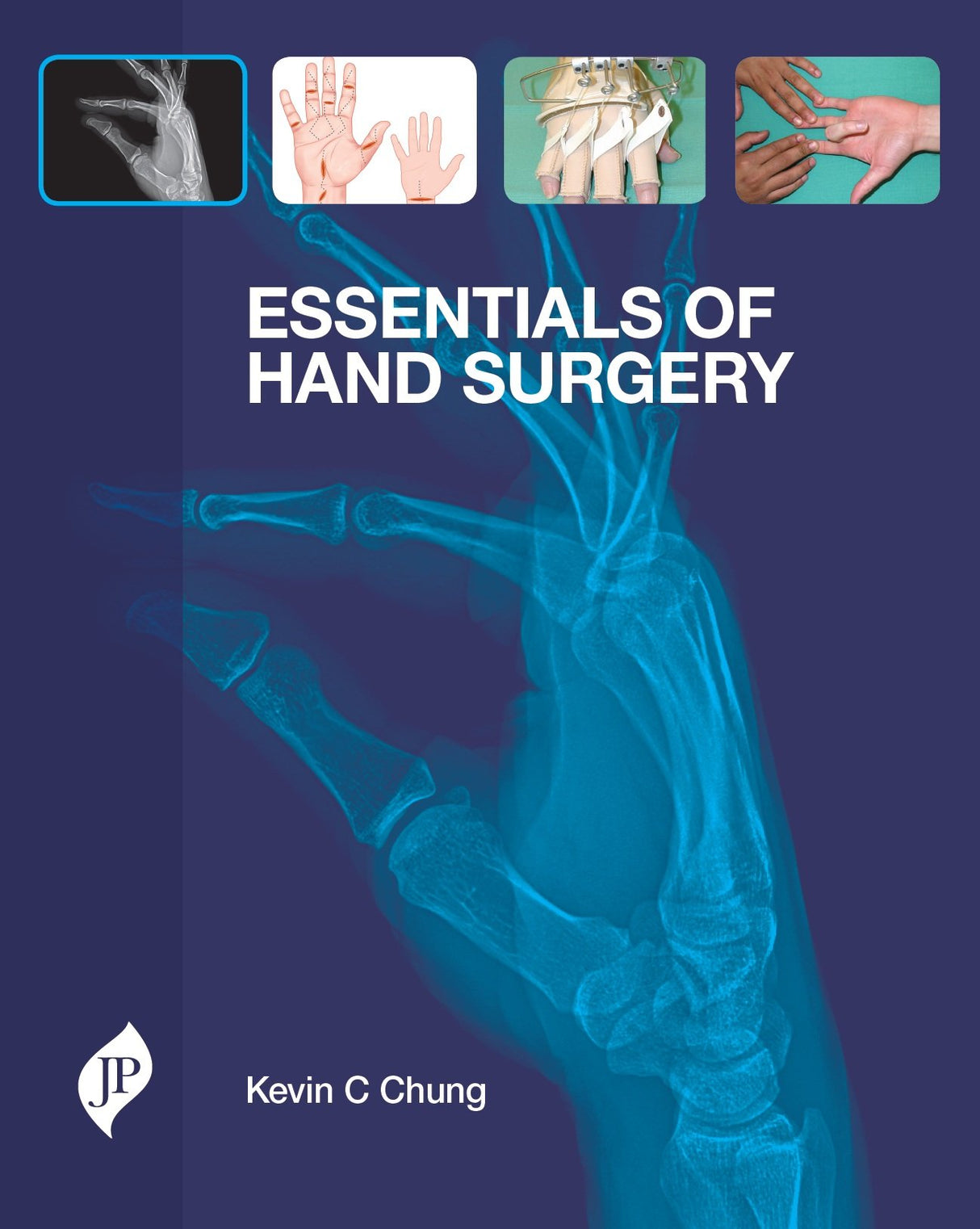 Essentials of Hand Surgery - Retail Maharaj