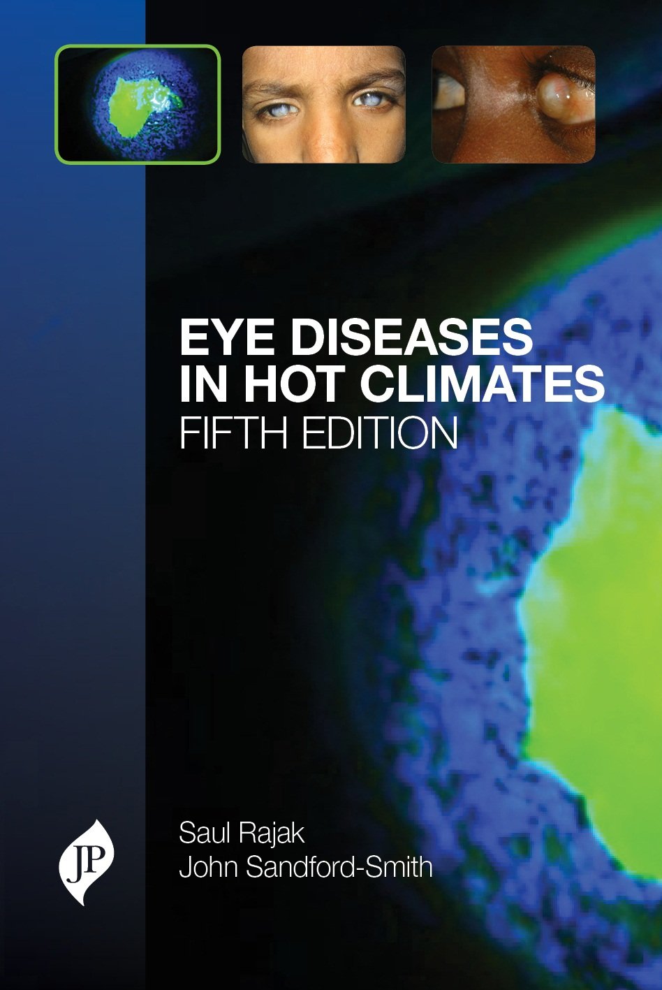 EYE DISEASES IN HOT CLIMATES - Retail Maharaj