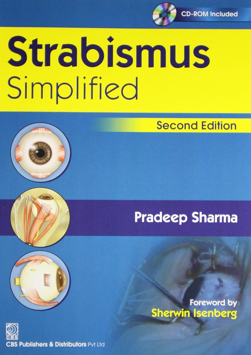 Strabismus Simplified 2Ed (Pb 2020) - Retail Maharaj