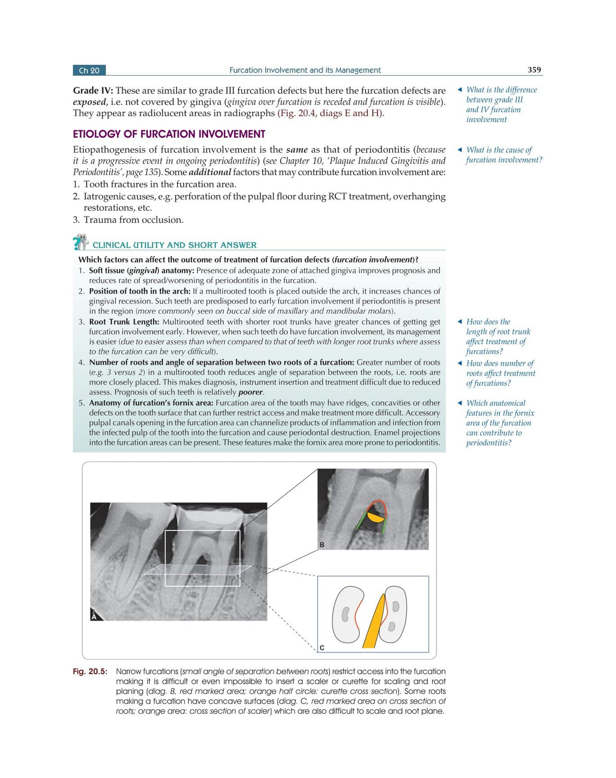 Textbook of Periodontology for Undergraduate Students - 2024 - Retail Maharaj