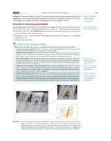 Textbook of Periodontology for Undergraduate Students - 2024 - Retail Maharaj