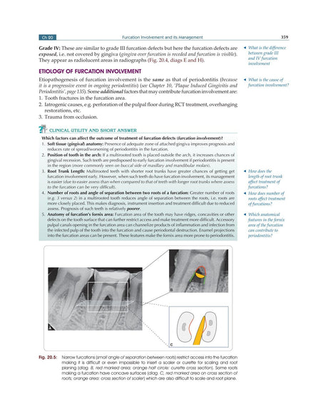 Textbook of Periodontology for Undergraduate Students - 2024 - Retail Maharaj