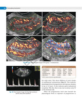 DECISION MAKING IN TRANSVAGINAL SONOGRAPHY - Retail Maharaj