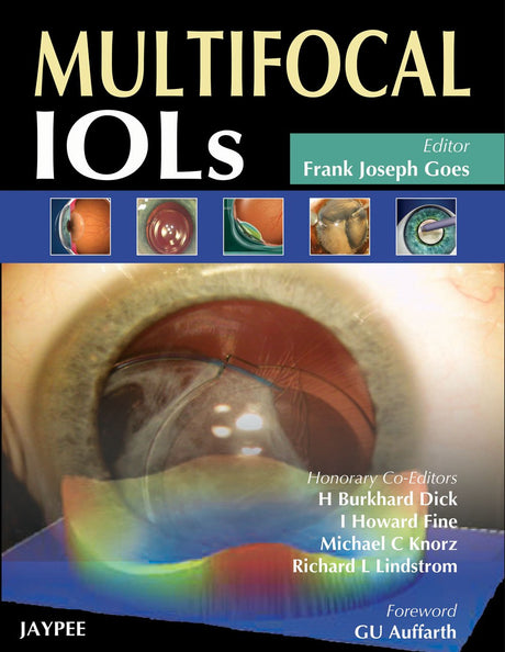Multifocal IOLs (POD) - Retail Maharaj