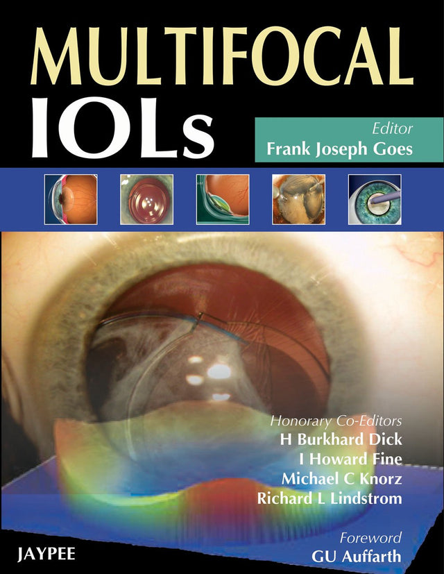 Multifocal IOLs (POD) - Retail Maharaj