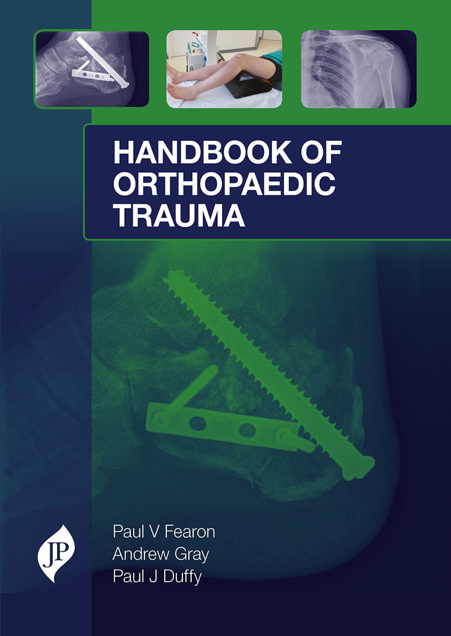 HANDBOOK OF ORTHOPAEDIC TRAUMA SURGICAL MANAGEMENT FROM ADMISSION TO REHABILITATION - Retail Maharaj