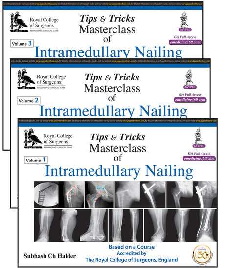 Tips and Tricks Masterclass of Intramedullary Nailing - Retail Maharaj