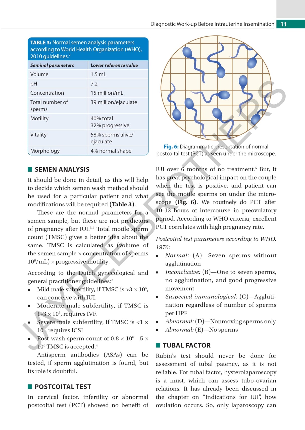 PRACTICAL GUIDE TO INTRAUTERINE INSEMINATION (IUI) - Retail Maharaj