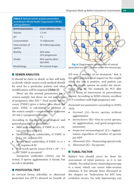 PRACTICAL GUIDE TO INTRAUTERINE INSEMINATION (IUI) - Retail Maharaj